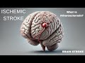 Brain Stroke What Is Ischemic Stroke Causes Atherosclerosis Condition Complete 3D Animation