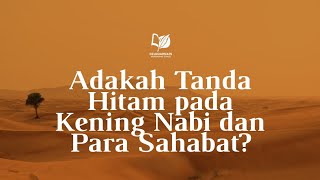 Download lagu Adakah Tanda Hitam pada Kening Nabi dan Para Sahabat? mp3