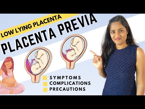 What is Low Lying Placenta - Placenta Previa? | Symptoms and Precautions for Placenta Previa