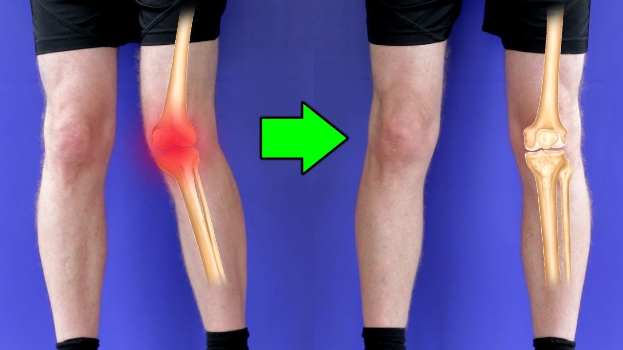 Knee Pain? This Is DESTROYING Your Knees