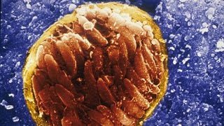 A Brain Parasite Might Be Making Us Angrier - Newsy