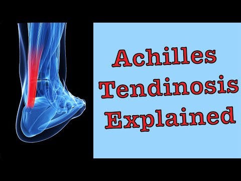 Achilles Tendinosis