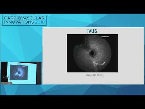 CVI2018 Session: An 80 Year Old Man With Chest Pain - Poonam Velagapudi, MD, MS