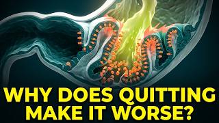 Why Do PPIs Stop Working After Long-Term Use