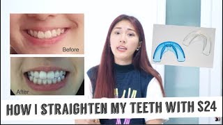 HOW I STRAIGHTEN MY TEETH WITH ONLY $24 + Giveaway || FATFOAL