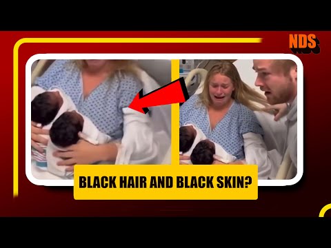 Black Hair & Black Skin? How a White Couple Had Black Twins! 😲