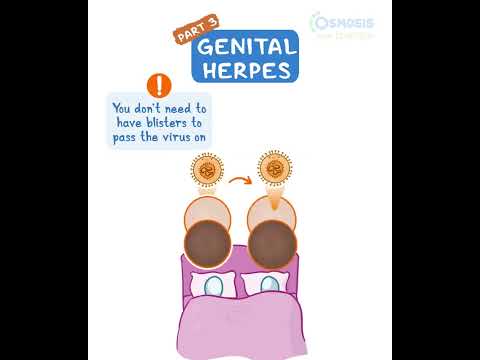 Diagnostics on Demand Cardiac tamponade