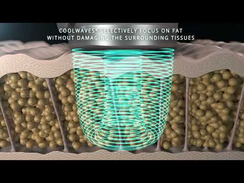 Discover the science behind Onda Pro Coolwaves