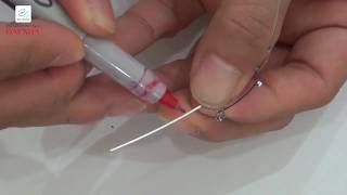 BẺ DÂY CUNG RICKETTS CHO HÀM TRÊN