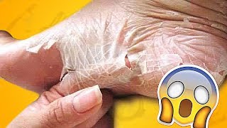 Китайские носочки для пяток инструкция по применению