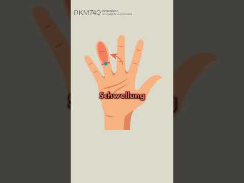 VERLETZUNG der HAND? Was du UNBEDINGT wissen musst!