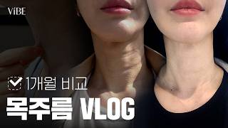 목주름 관리, 언제부터 시작해야 할까? 직접 시술받고 왔습니다