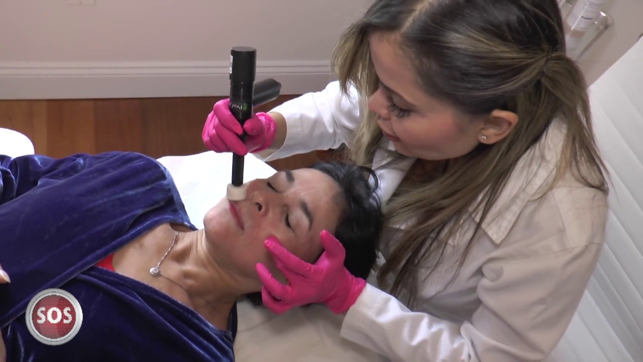 REJUVENECIMIENTO FACIAL CON CELULAS MADRE