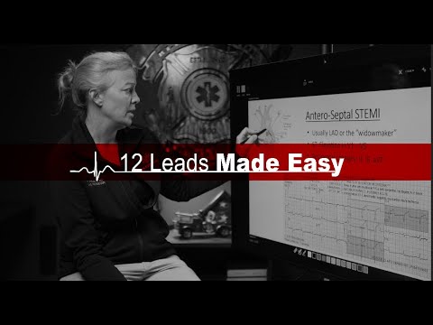 How to Read 12 Lead EKGs