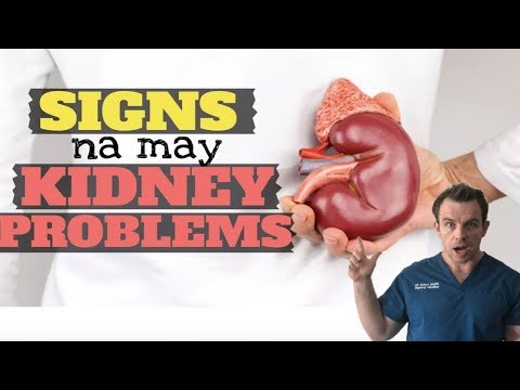 Pamamaraan ng pagbaba ng timbang ng droga Squats na may barbell para sa slimming babae