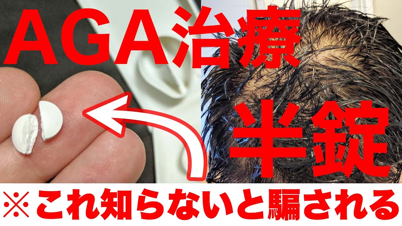 【騙されるな】フィナステリドは0.5mgからでいいんじゃないか説【分割】