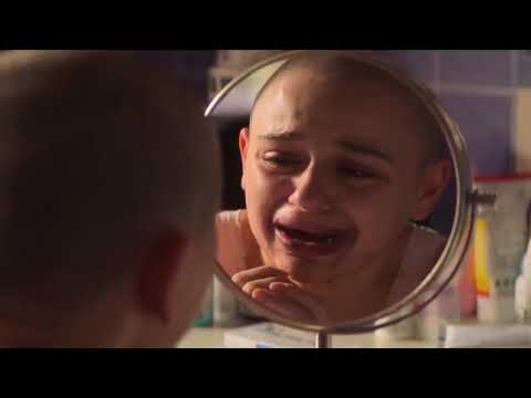 The Act Ep. 2: Gypsy's reaction after teeth extraction