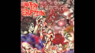 Artery Eruption - 