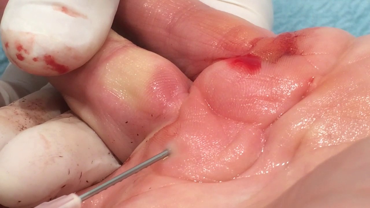 Javier De La Fuente Ortiz De Zarate-2