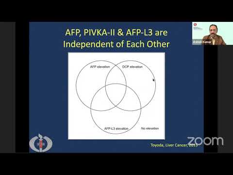 Serum Biomarkers for Hepatocellular Carcinoma