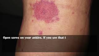 What could be reasons for spots on legs