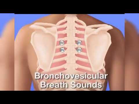 BRONCHOVESICULAR LUNG SOUND