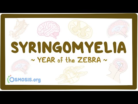 Syringomyelia (Year of the Zebra)