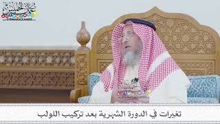 40 - تغيرات في الدورة الشهرية بعد تركيب اللولب - عثمان الخميس