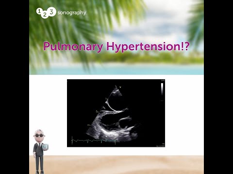 Case Study from Adult Congenital Heart Disease BachelorClass
