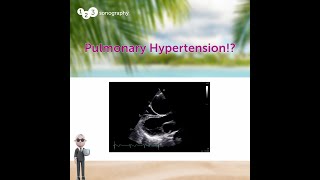 Case Study from Adult Congenital Heart Disease BachelorClass