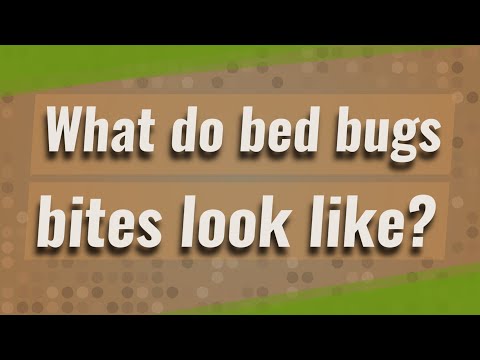 What do bed bugs bites look like?