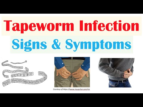 Tapeworm Infection Signs & Symptoms, Nutrient Deficiencies, & Complications