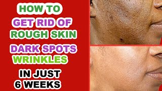 HOW TO GET RID OF ROUGH SKIN, DARK SPOTS, WRINKLES AND FINE LINES IN JUST 6 WEEKS