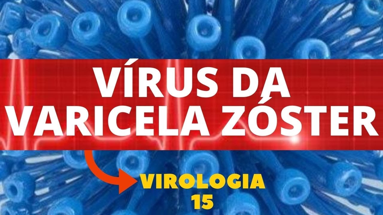 VÍRUS DA VARICELA ZÓSTER - VIROLOGIA - AULA 15