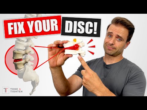 FIX YOUR DISC! Bulging Disc Lower Back Exercises For Pain Relief Video