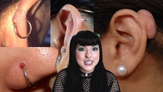 What Are Those Bumps On Your Piercings? & How to Get Rid Of Them | Piercer Explains