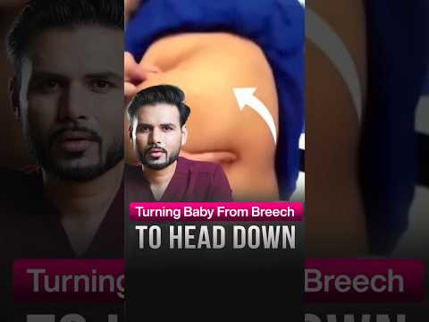 BREECH baby flip, How is it done? | ECV (External Cephalic Version)