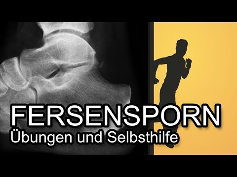 Diabetiker kann ich das Recht bekommen Behandlung von Diabetes und Soda. Neumyvakin