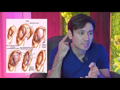 Otoplastika — Dr. Choriyev #1