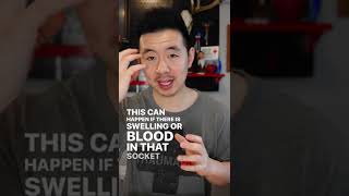 Name This Eye Injury! #survivalmedicine #shorts