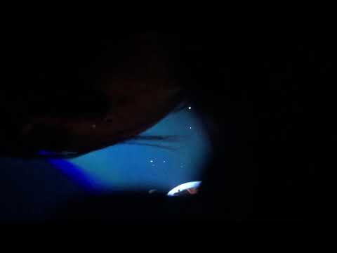 180304 everyday6 finale 원필 밤편지