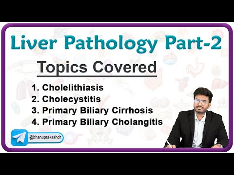Liver Pathology : Cholelithiasis, Cholecystitis, Primaribiliary Cirrohosis and Cholangitis