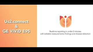 Download lagu AI Echocardiography   the future of echo with Us2 connect mp3