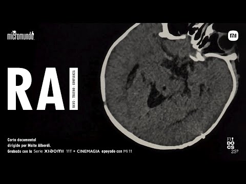 Xiaomi - RAI, dirigido por Maite Alberdi | #SerieXiaomi11T