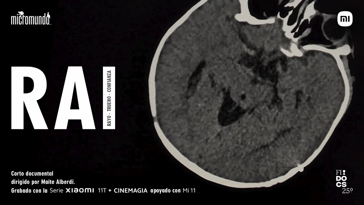 Xiaomi - RAI, dirigido por Maite Alberdi | #SerieXiaomi11T