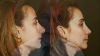 Glasgold Group Plastic Surgery