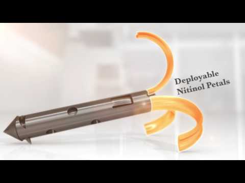 Zift Medical Product Animation