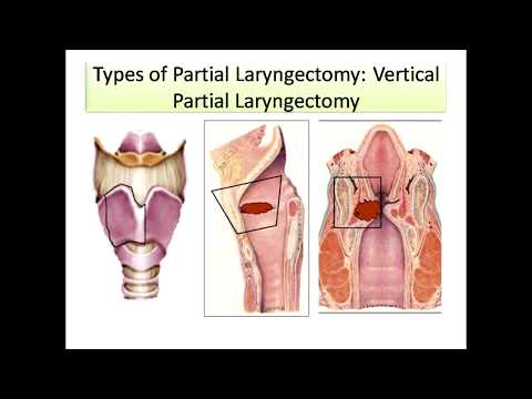 CCR-_ENT_ [ 08.03.2016 ]