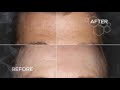 Συσκευή DF MOBILE Skincare Device Environ