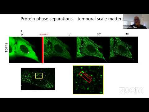 2nd Workshop in Advanced Microscopy and Biophotonics - 2020 //UBA IPMON&UdelaR